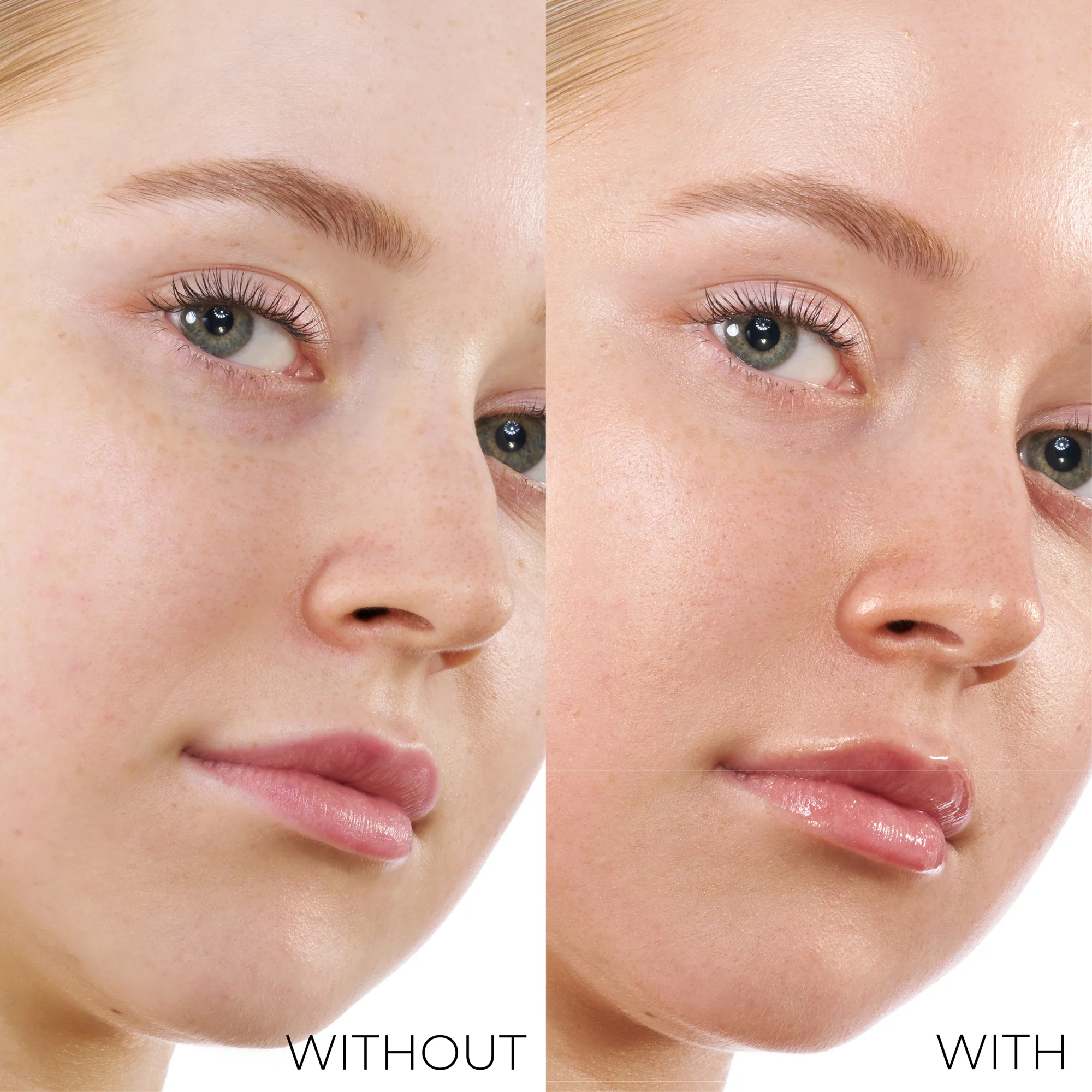 341-hy-gen-bronze-4.webp HY-GEN BRONZE